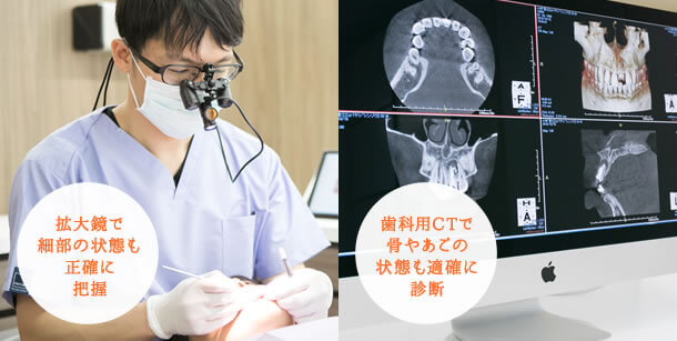 拡大鏡で細部の状態も正確に把握、歯科用CTで骨やあごの状態も適確に診断