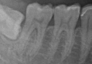 PBN11188_250913090659